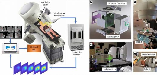 Tracking radiation treatment in real time promises safer, more effective cancer therapy