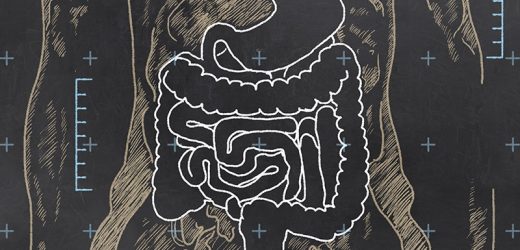 Adult Stem Cells Can Heal Intractable Perianal Crohn’s Fistulae