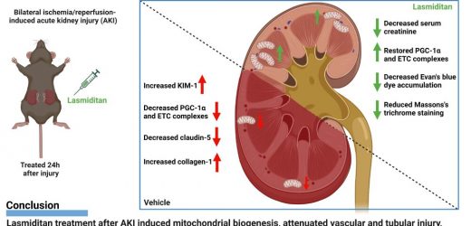 Migraine drug shows promise in treatment of acute kidney injury