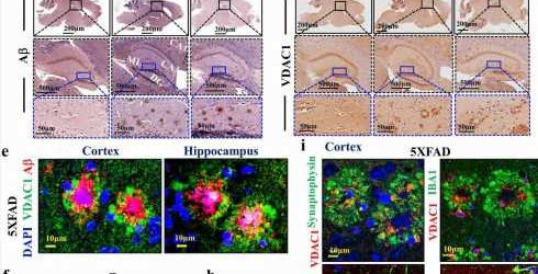 New approach for treating Alzheimer’s shows success in mouse models