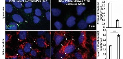 Scientists discover biomarkers and therapies for a group of fatal pediatric neurodegenerative disorders