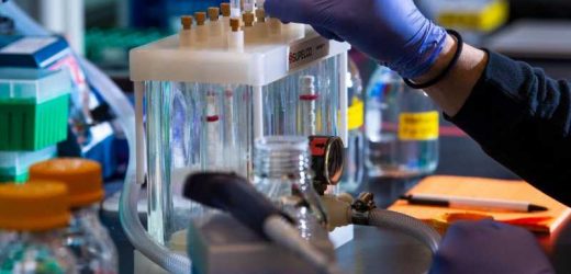Scientists study proteins to understand Alzheimer’s, degenerative brain disorders