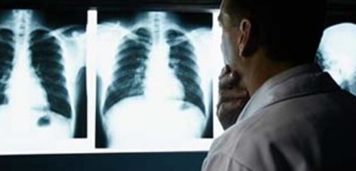 Targeted drug tagrisso could be advance against lung cancer