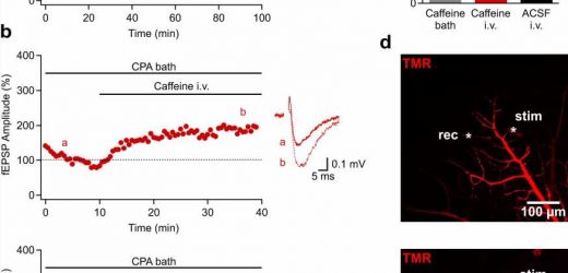 Tracking down leaks in the blood-brain barrier