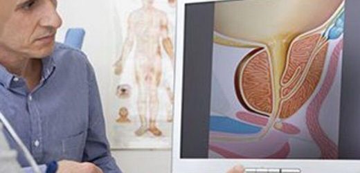 2014 to 2021 saw increase in use of active surveillance for low-risk prostate cancer
