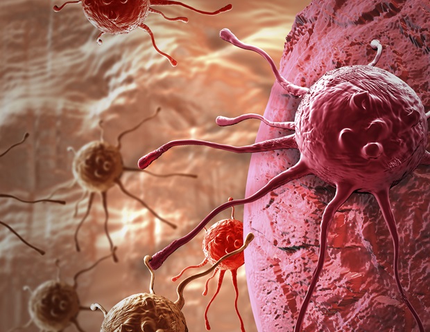 Advanced surgical therapy proves to be effective for patients with uveal melanoma liver metastases