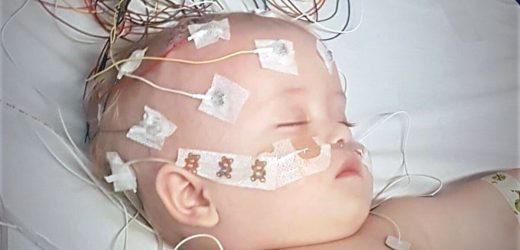 Baby suffered ‘bulging’ eyes and ‘swollen’ head due to brain tumour