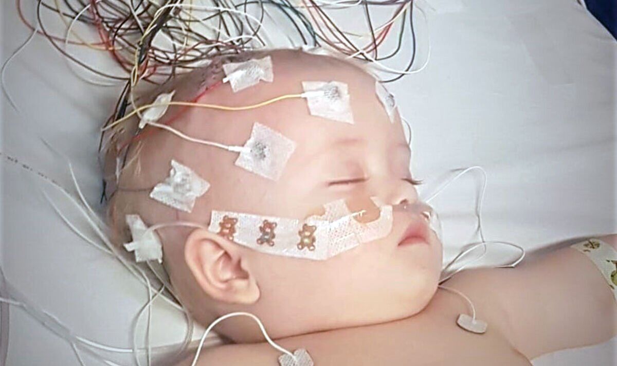 Baby suffered ‘bulging’ eyes and ‘swollen’ head due to brain tumour