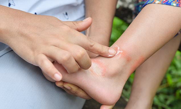 Bath oils used to soothe skin of kids with eczema &apos;do NOT help&apos;