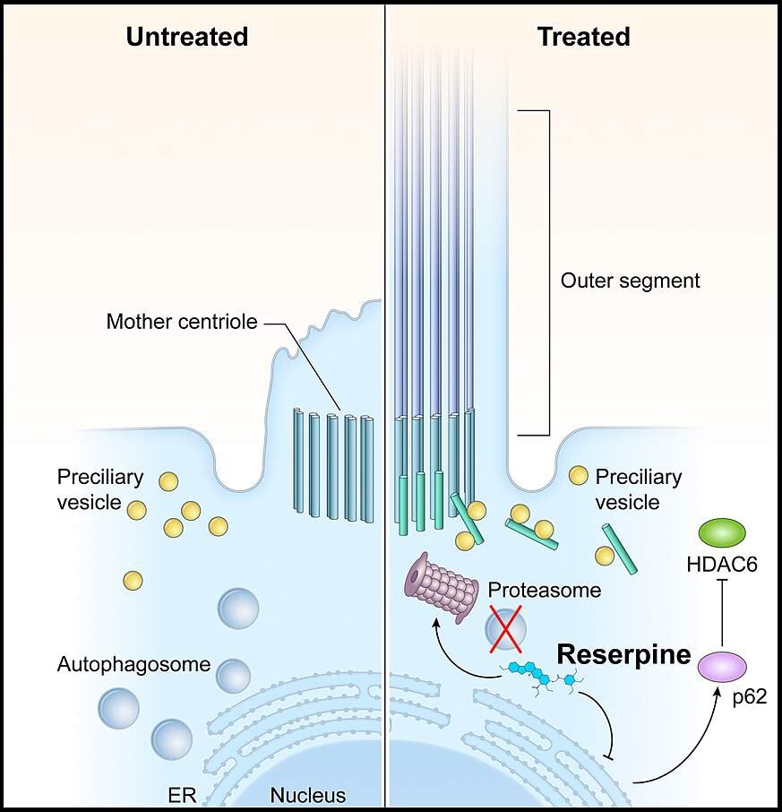 FDA-approved drug shows promise in lab models for childhood blinding disease