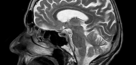 How neuroimaging can be better utilized to yield diagnostic information about individuals
