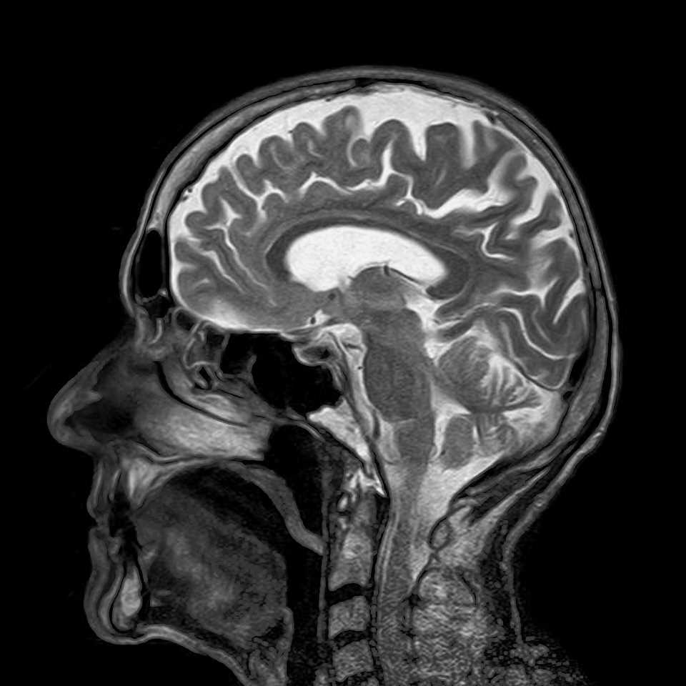 How neuroimaging can be better utilized to yield diagnostic information about individuals