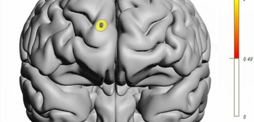 Long COVID linked to lower brain oxygen levels, cognitive problems and psychiatric symptoms