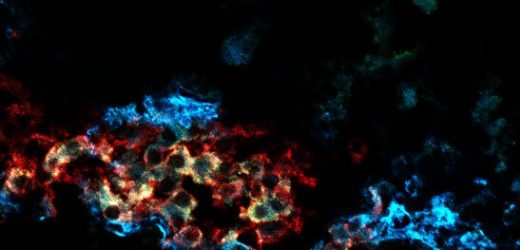 Losing a key type of pancreatic cell may contribute to diabetes