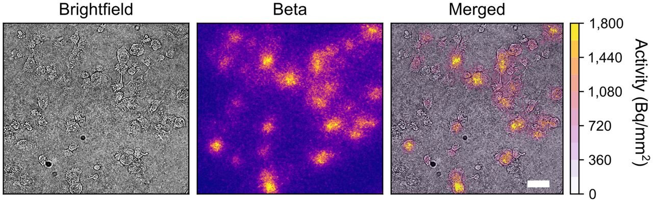 New compact and low-cost lensless radiomicroscope developed for nuclear medicine imaging