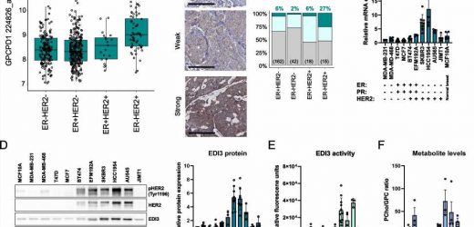 New potential therapeutic approach for HER2-positive breast cancer discovered