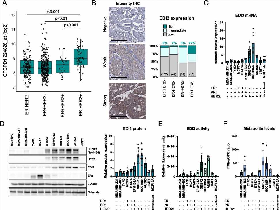 New potential therapeutic approach for HER2-positive breast cancer discovered