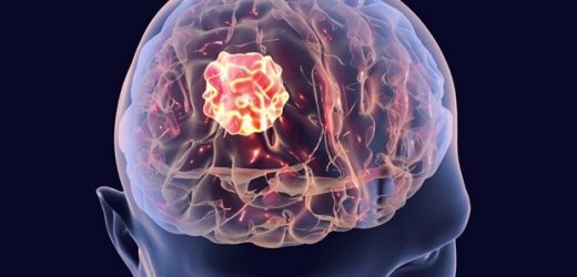 New research pinpoints key culprit behind brain cancer metastasis in children