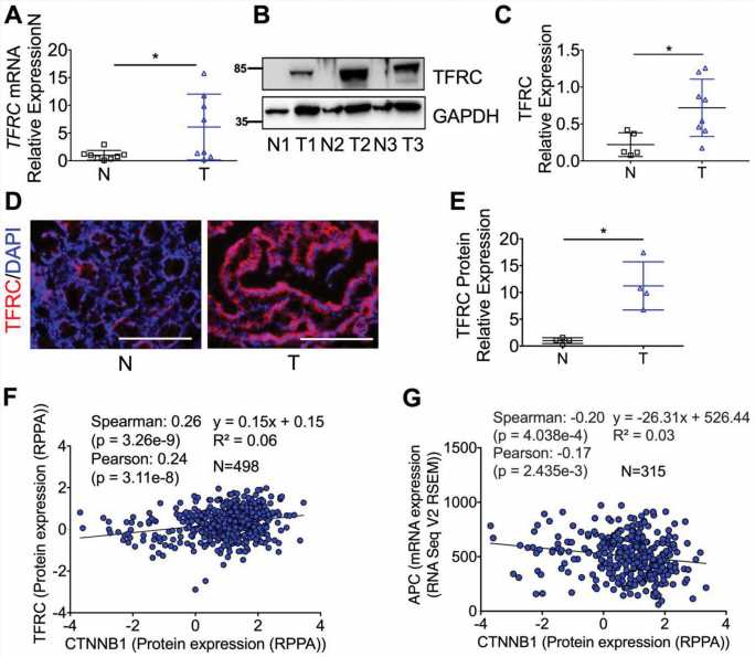 Scientists describe how iron helps drive tumor development in colorectal cancer