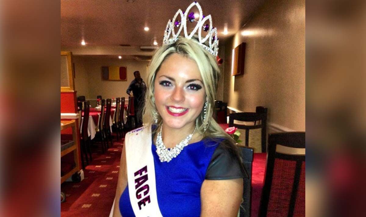17-year-olds first stroke sign hit her eyes during a dance class