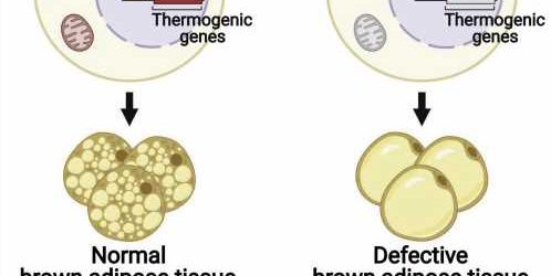 Can brown fat cells combat obesity?