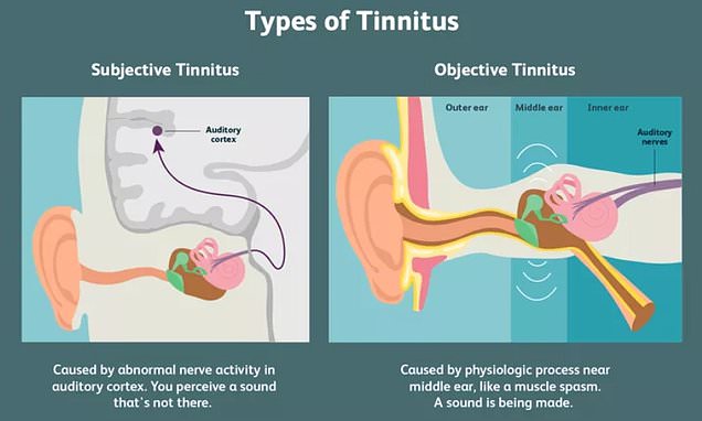 Covid vaccines and tinnitus: What we know so far