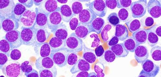 Investigational drug may improve stem cell transplantation for multiple myeloma patients