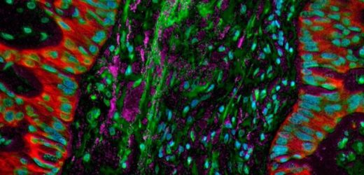 Lung cancers molecular features shed light on immunotherapy response