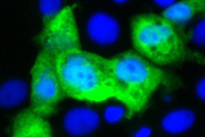 New approach targets norovirus, worlds leading cause of foodborne infection