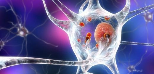 New form of levodopa might improve parkinsons care