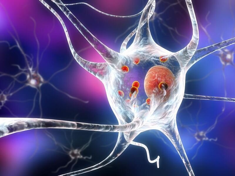New form of levodopa might improve parkinsons care