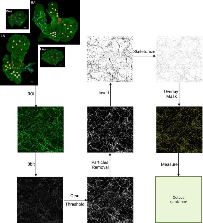 Researchers create digital map of sympathetic nervous system