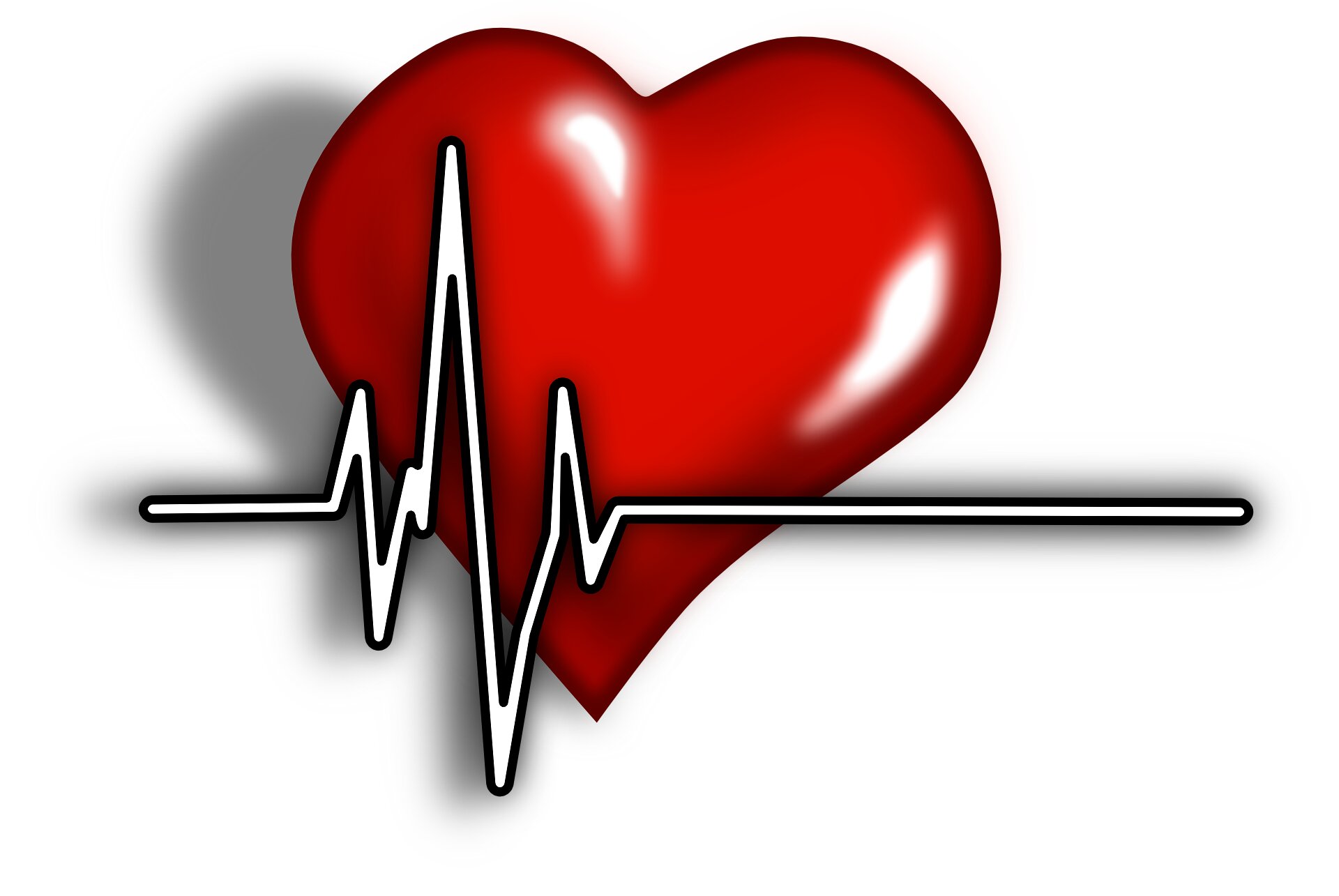 Study: Low-income people have heightened risk of death from heart attack in six health systems around the world