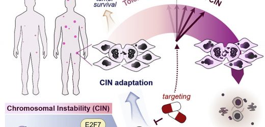 Study suggests chromosomal errors may hinder some aggressive tumors