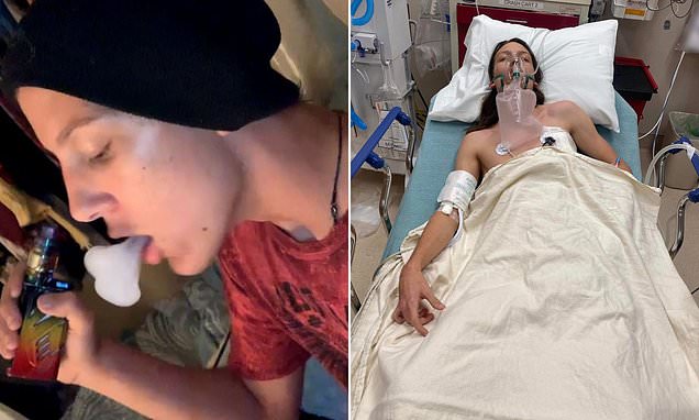 Vape-addicted teen claims habit caused his lungs to collapse 4 times
