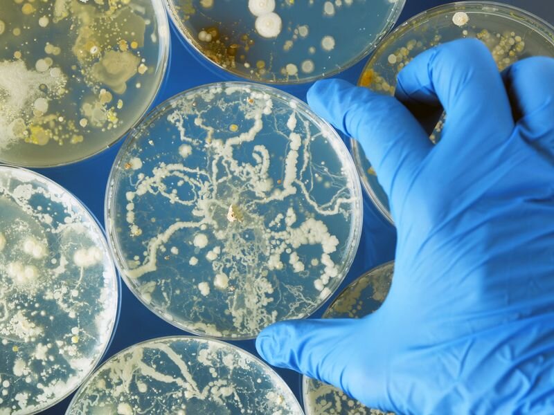 Wisconsin fungal infection sickened 4 people, 5 dogs