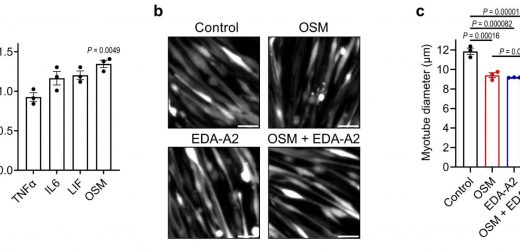 An elusive mechanism of wasting syndrome cachexia revealed