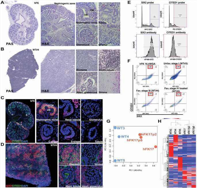 Researchers uncover new clues to origins of the most common pediatric kidney cancer