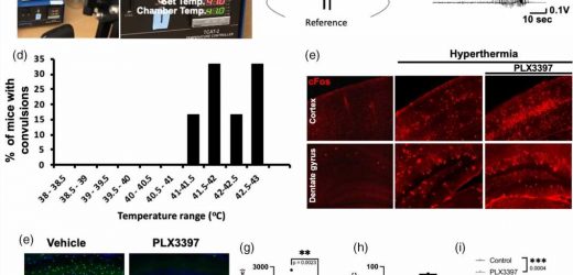 Seizure discoveries advance efforts to develop better treatments
