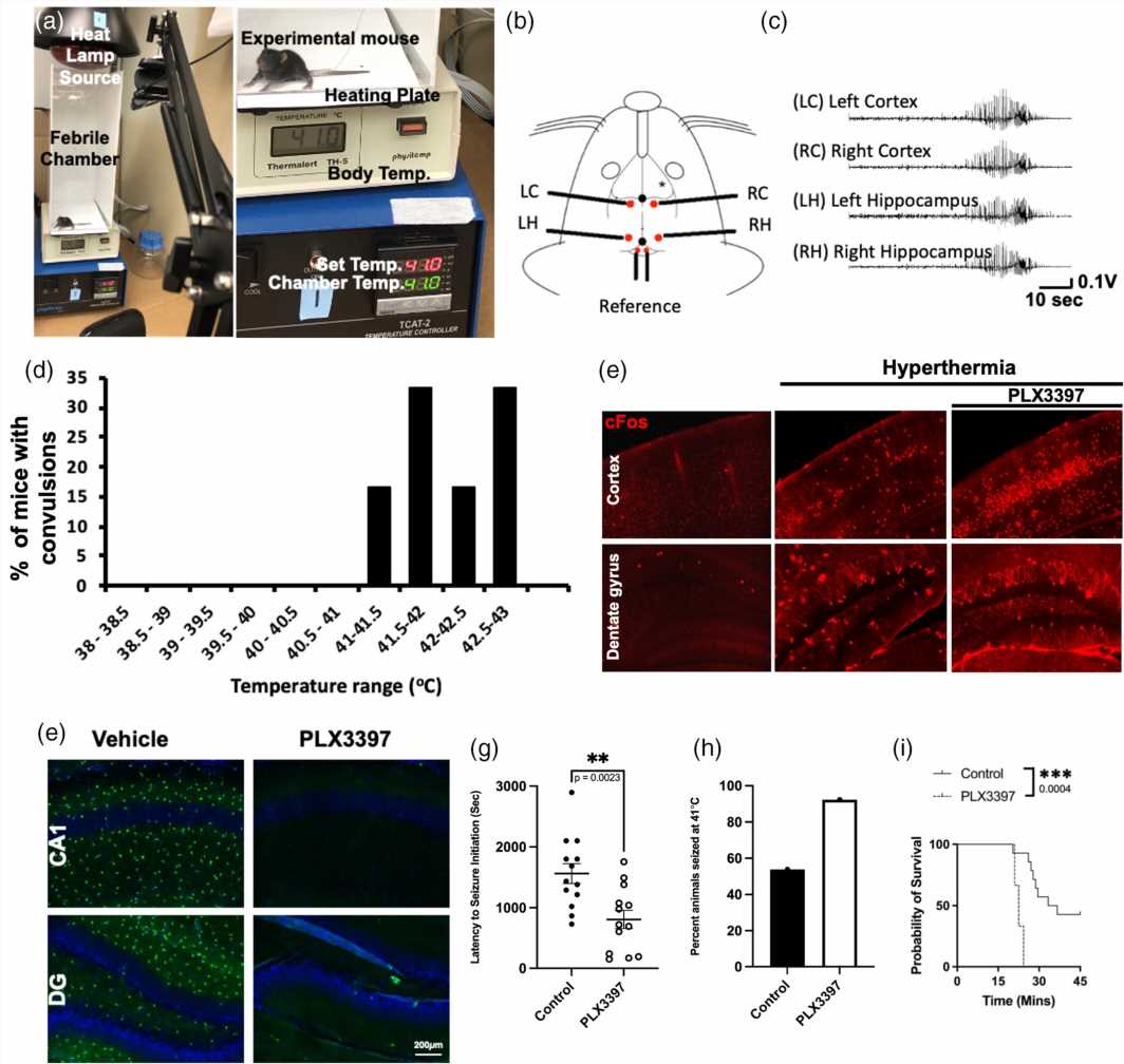 Seizure discoveries advance efforts to develop better treatments