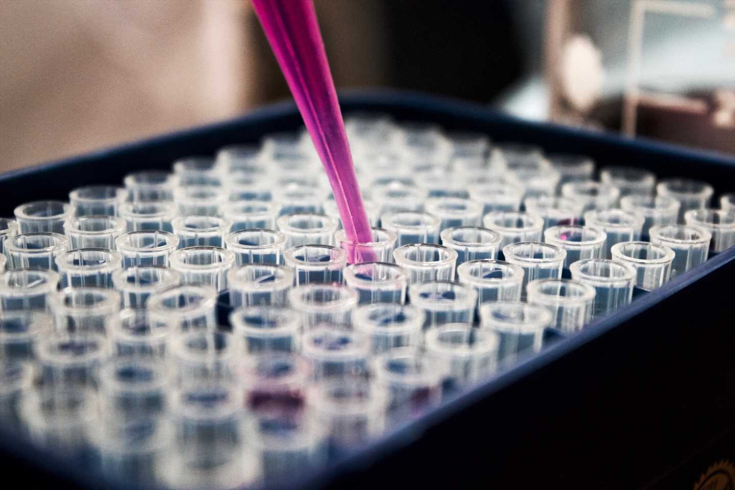 Study demonstrates clinically relevant deficiency of the bonding hormone oxytocin