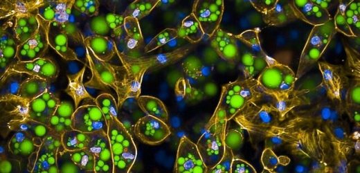 Study finds how a genetic variant raises diabetes risk through an unexpected mechanism