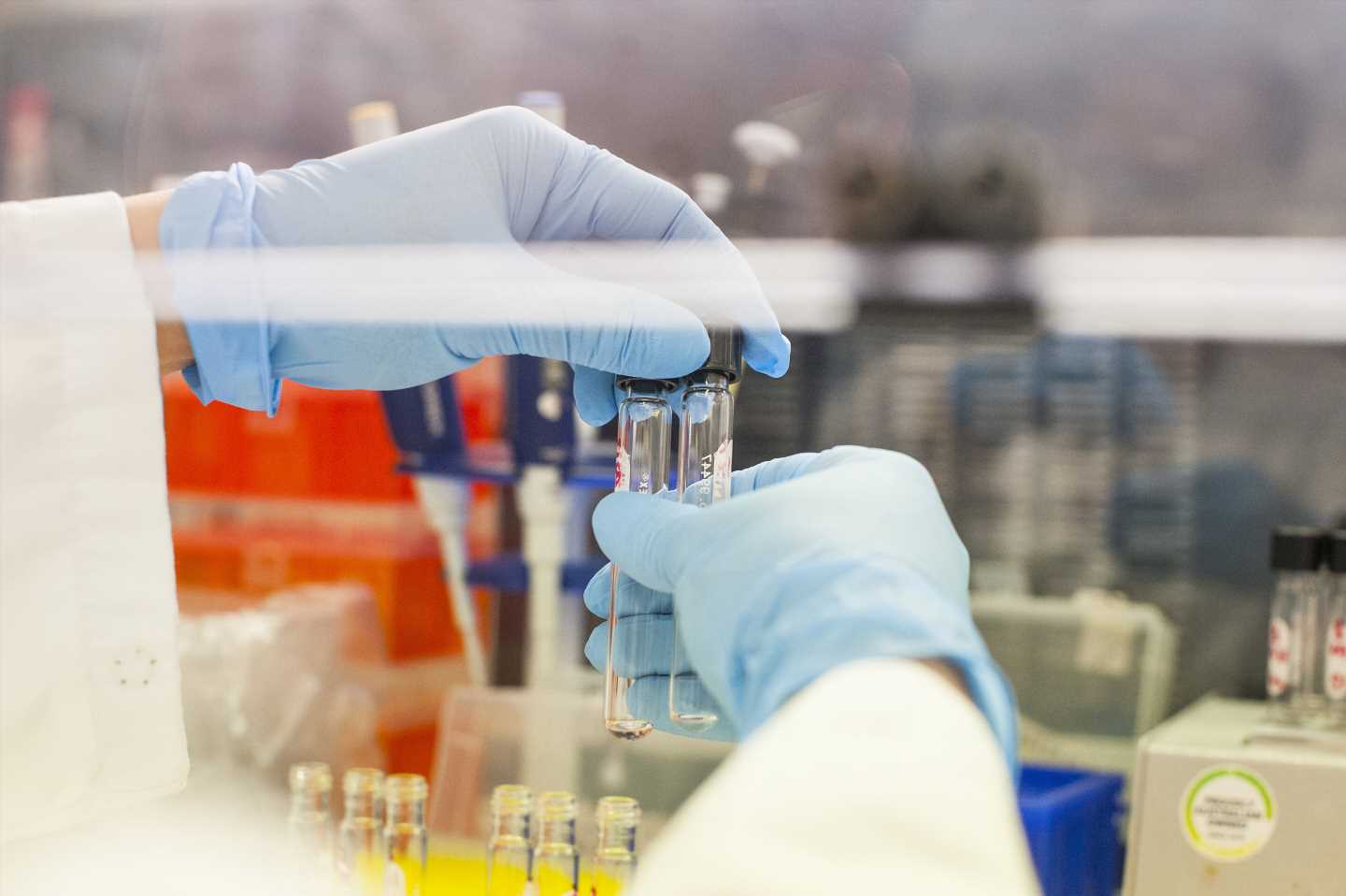 Study finds some motor neuron disease and dementia patients share genetic defects