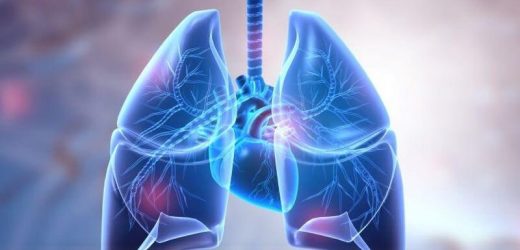 U.S. Preventive Services Task Force recommends screening at-risk persons for latent TB infection