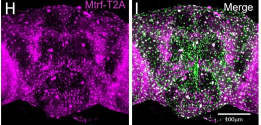 Variants of MRTFB gene linked to novel neurodevelopmental disorder