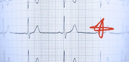 Women more likely than men to die after heart attack, study finds