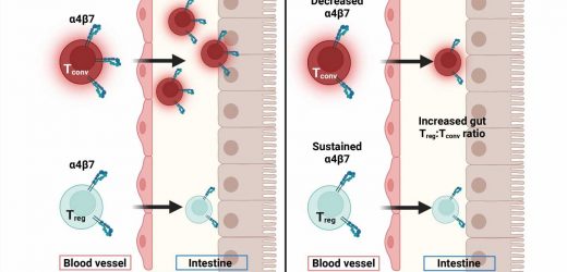 Antibody treatment prevents intestinal graft versus host disease in preclinical tests