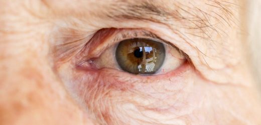 Can you really address annoying eye floaters with a supplement?