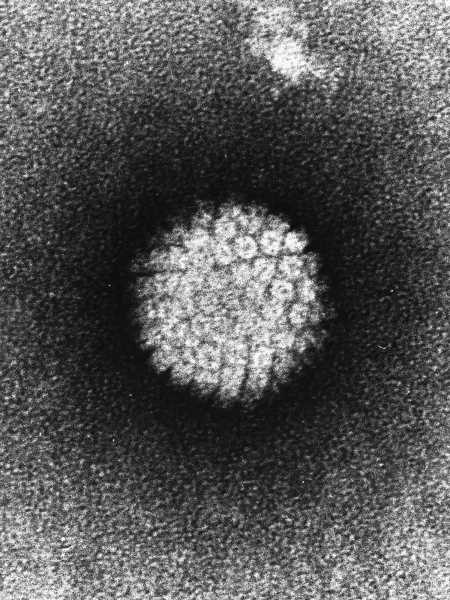 Cancer experts warn about wave of HPV-related cancers in adults