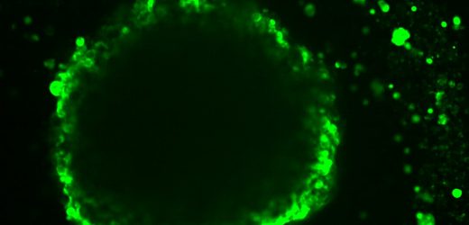 Researchers show how a tumor cells location and environment affect its identity